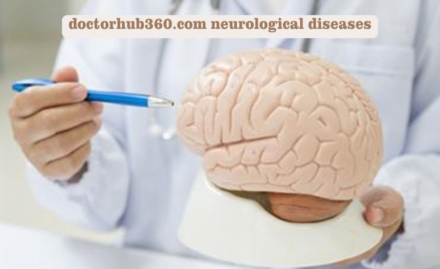 doctorhub360.com neurological diseases